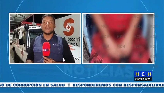 Mientras jugaba, menor de 14 años cae de árbol y se fractura ambos brazos en Copán