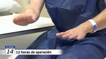 Daniel ya tiene tres dedos de sus pies implantados en su mano