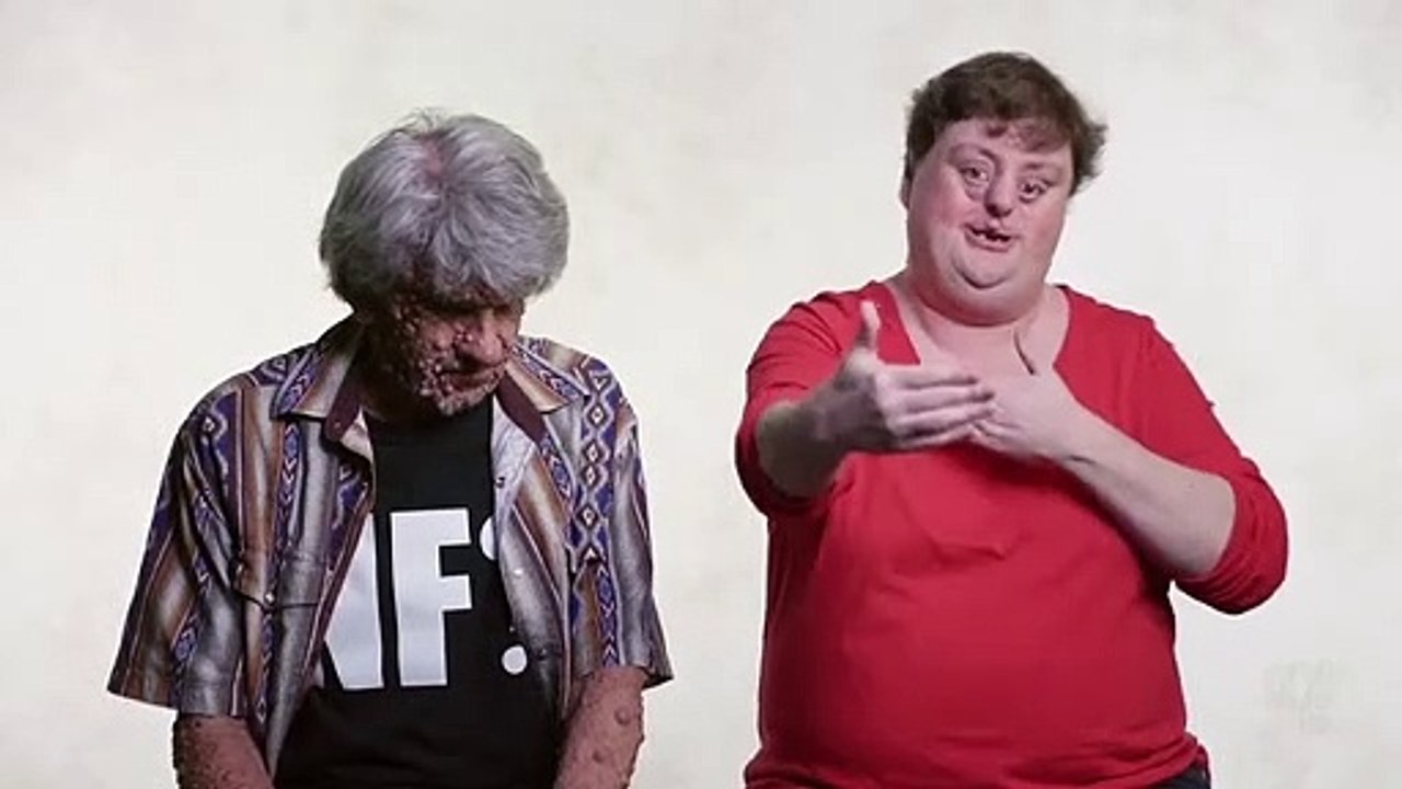 You Can't Ask That - Se2 - Ep05 - Facial Difference HD Watch HD Deutsch