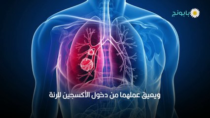 كل ما تريد معرفته عن سرطان الرئة عند الأطفال