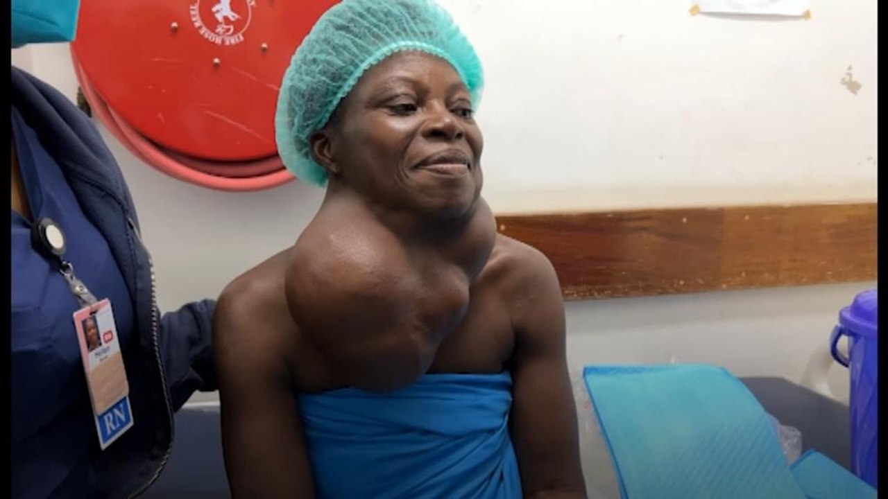 Ghana-born top US doctor performs free reconstructive surgeries in Africa