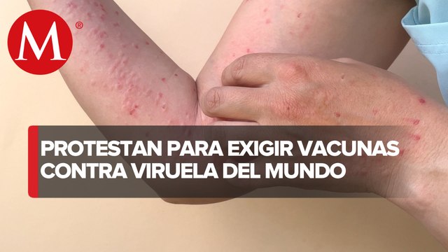 Manifestantes exigen vacunas contra viruela del mono en CdMx