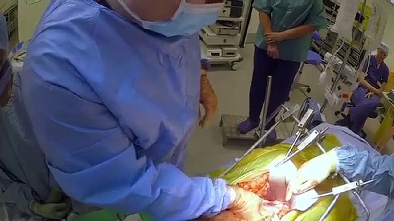 Surgeons - At the Edge of Life - Se2 - Ep05 - Getting Better HD Watch HD Deutsch