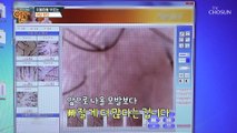 앞으로 빠질 머리가 더 많다는 사연자의 두피 상태 TV CHOSUN 20221023 방송