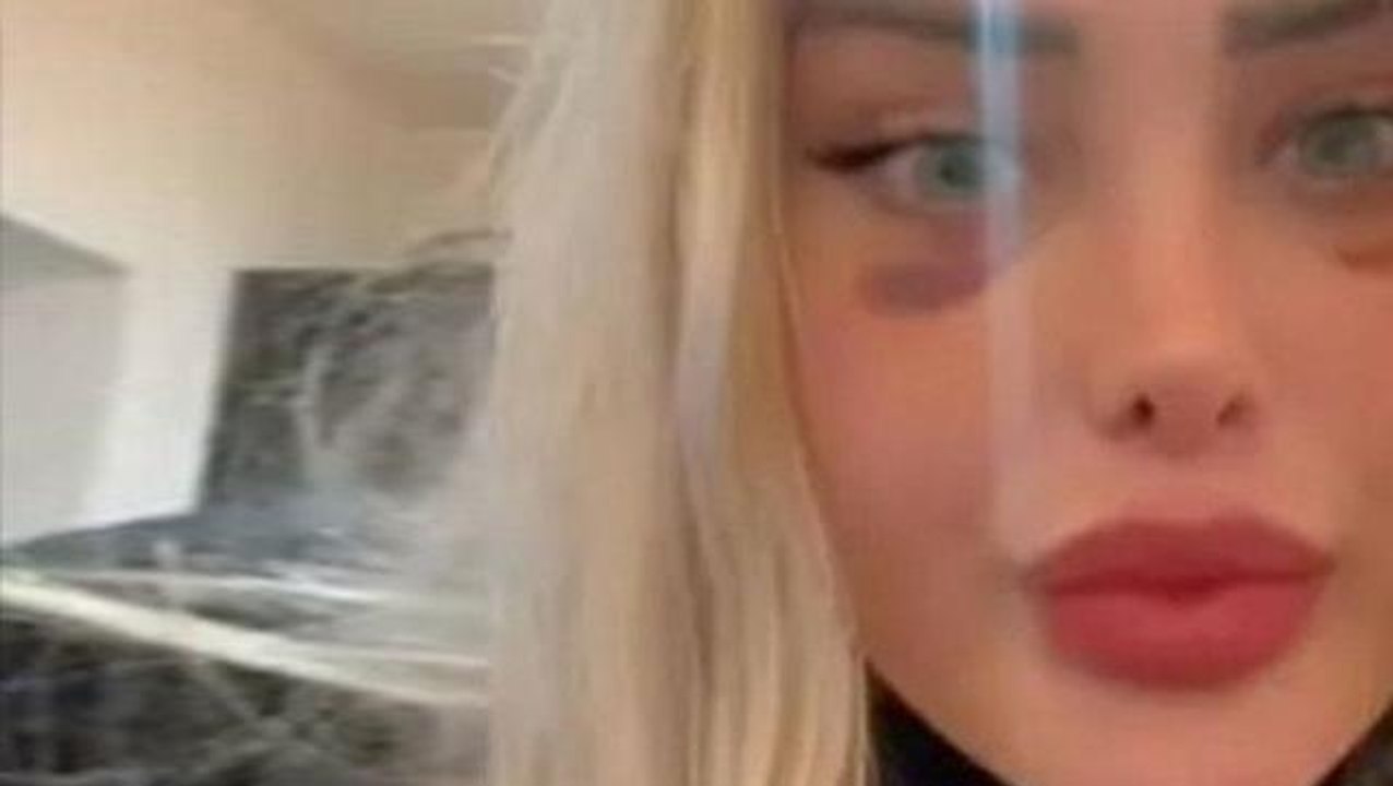 Kan basıncı uçaktayken aniden fırlayan fenomenin adeta kafası patladı