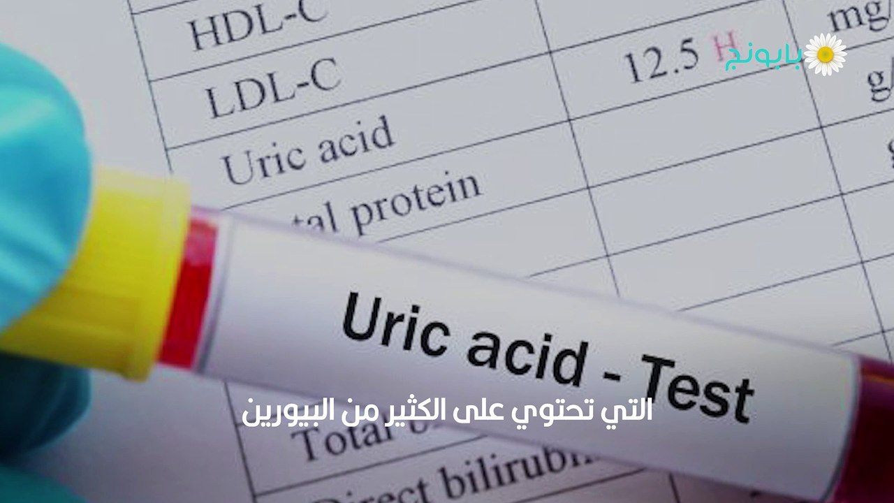 كيفية إزالة اليوريك أسيد من الجسم وتقليل نسبته للحد الأدنى (1)
