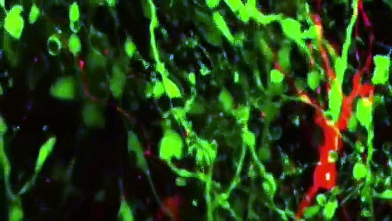 TED Talk - How We're Reverse Engineering the Human Brain in the Lab