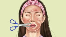 ASMR Chemical peeling skin on the face _ Dermaplaning skincare treatment animati