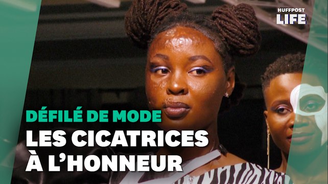 En Ouganda, ce défilé de mode met à l'honneur les cicatrices