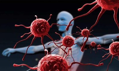 جامعة سعودية تكتشف تركيبة فعالة لعلاج السرطان