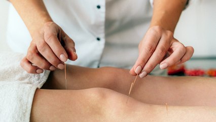 Akupunktur Tekniklerini Öğrenin - Akupunktur APK