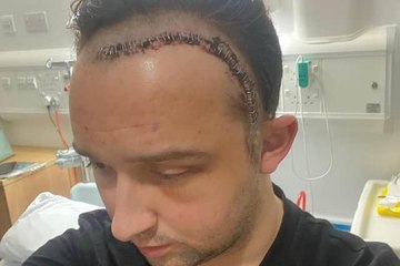 Edinburgh Headlines October 25: Man prescribed headache tablets before scan revealed terminal brain tumour