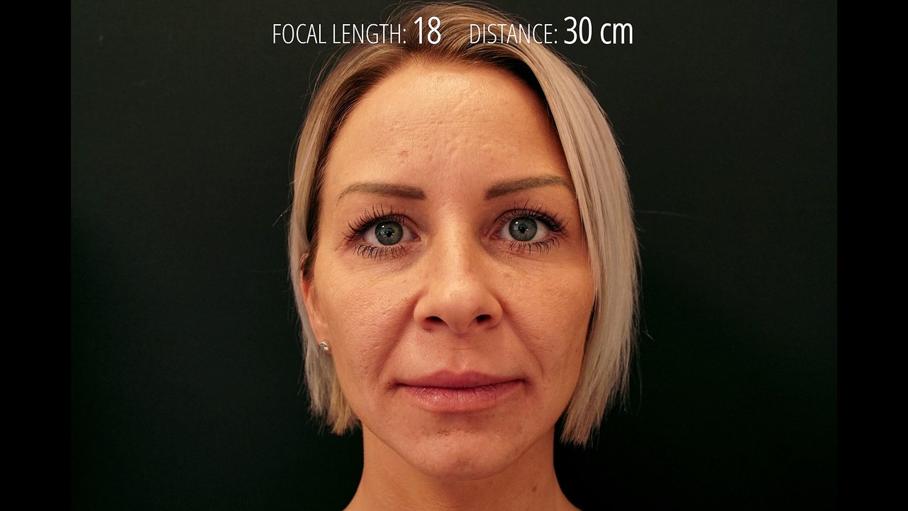 Wie eine Selfie-Aufnahme das Gesicht verzerrt