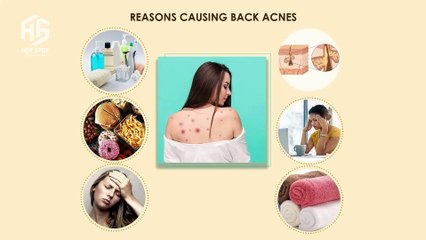 ASMR A adolescent girl's face with acne and freckles is treated