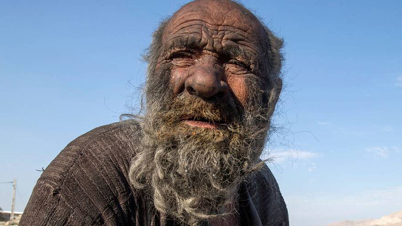 World's Dirtiest Man का कैसे हुआ निधन, चौंकाने वाली वजह आई सामने | Boldsky *Lifestyle