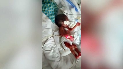 A premature baby whose heart stopped beating for 17 minutes has beaten the odds to come home - after more than three months in hospital.