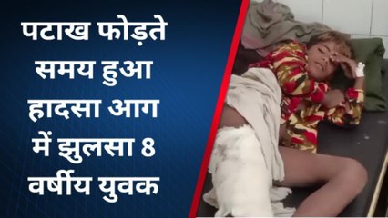 अशोकनगर:पटाखे से झुलसा आठ वर्षीय मासूम,अस्पताल में उपचार जारी