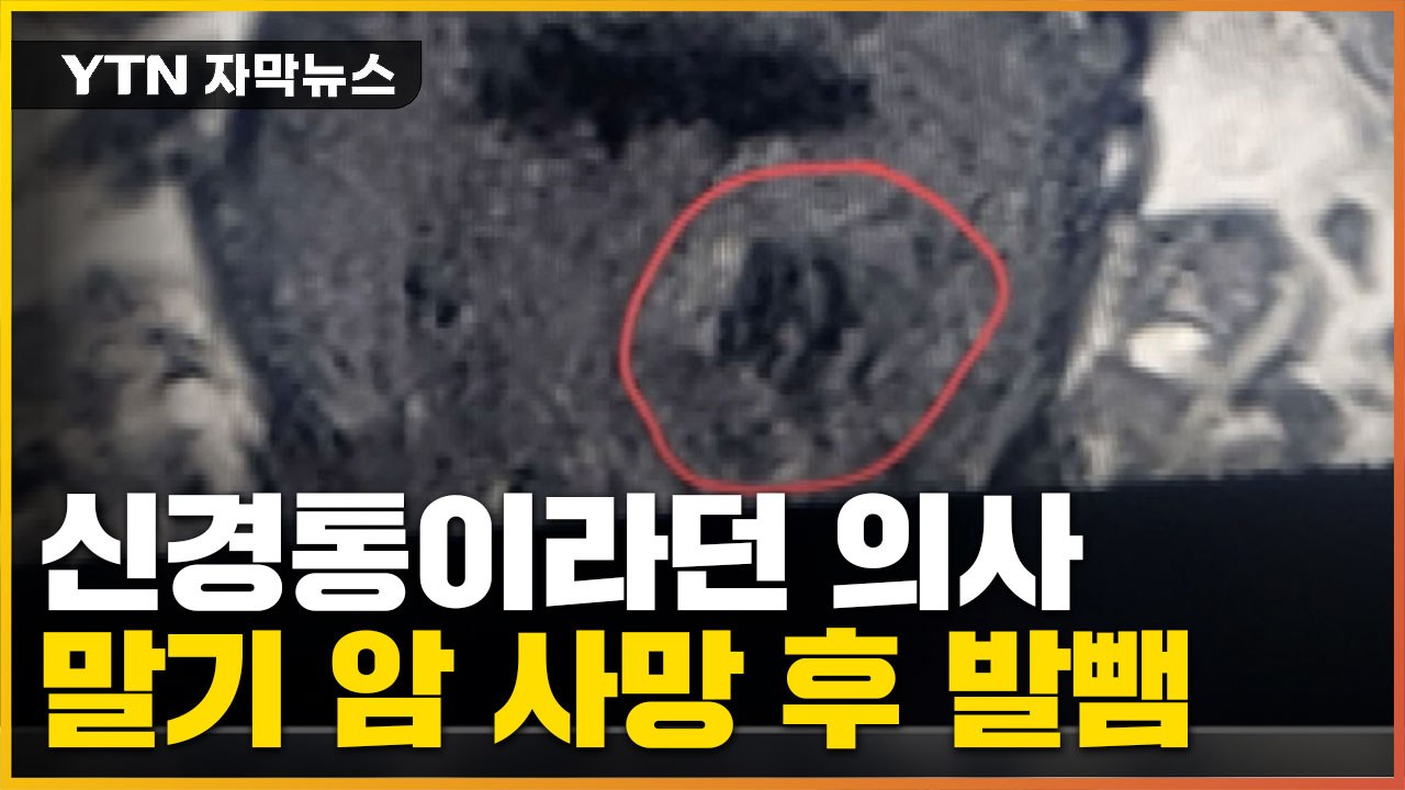 [자막뉴스] 신경통이라던 대학 병원 의사... 사망 후 밝혀진 충격적 결과 / YTN