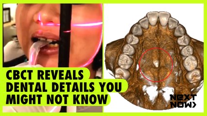 CBCT reveals dental details you might not know | Next Now