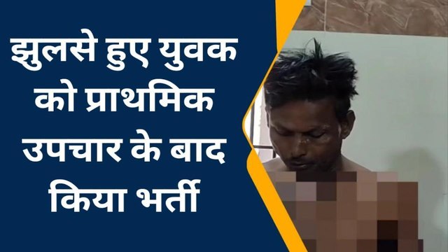 मुरैना : करंट लगने से युवक बुरी तरह से झुलसा, अस्पताल में कराया प्राथमिक उपचार