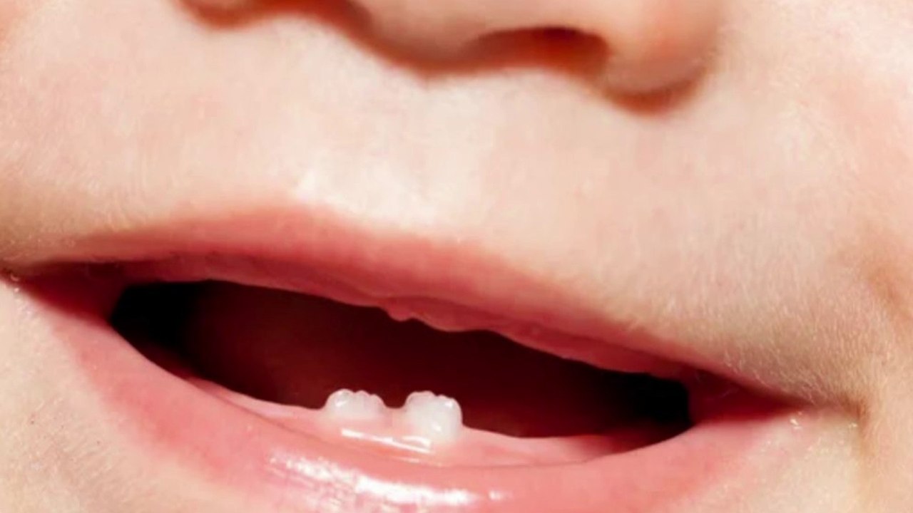 bd-lo-que-debe-saber-sobre-salida-de-primeros-dientes-271022