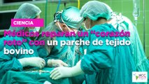 Médicos reparan un “corazón roto” con un parche de tejido bovino