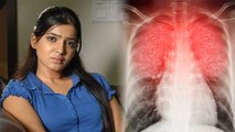 Samantha Prabhu Myositis बीमारी से ग्रसित, क्या है लक्षण,क्या होता है शरीर पर असर |Boldsky*Health