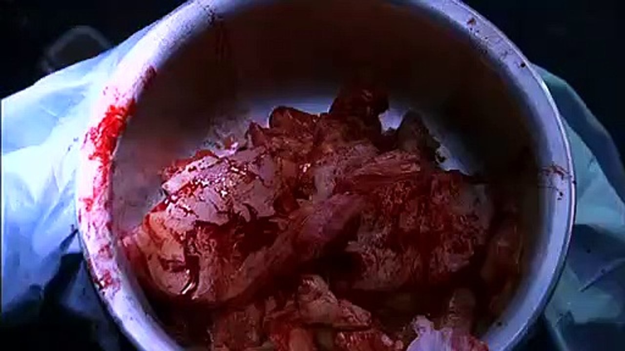 Nip-Tuck - Se1 - Ep06 HD Watch HD Deutsch
