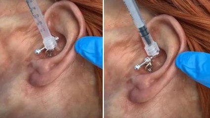 Kadının kulağından çıkan cisim, izleyen herkesi hayretler içerisinde bıraktı