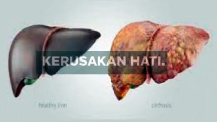 Apa saja efek samping penggunaan paracetamol yang berlebih?
