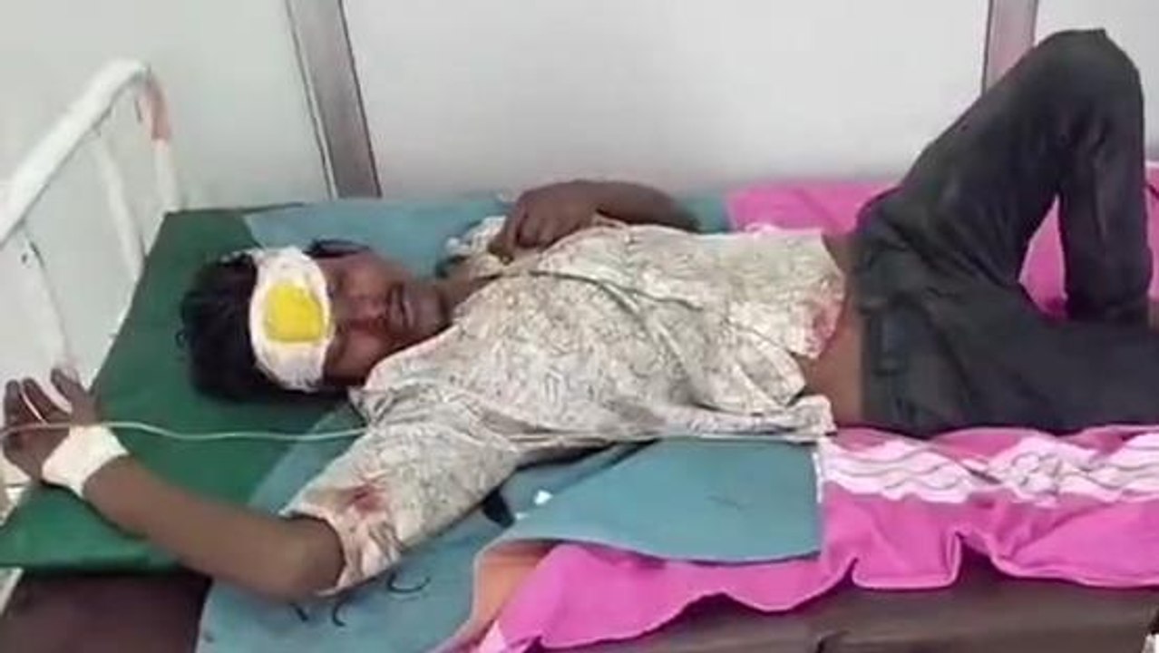 குடிபோதையில் மாறி மாறி தாக்கி கொண்ட நண்பர்கள்  !