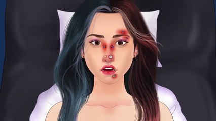 ASMR treatment of infections caused by wearing facial piercing __ Asmr treatment Animation __ ASMR