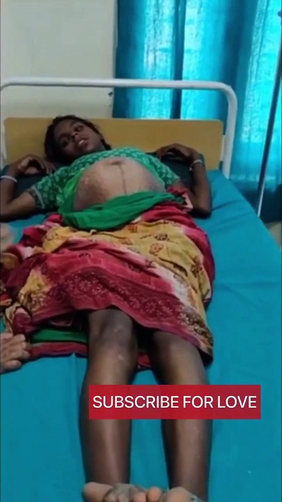 Natural baby birth with normal delivery in our government hospital india #shorts #newborn