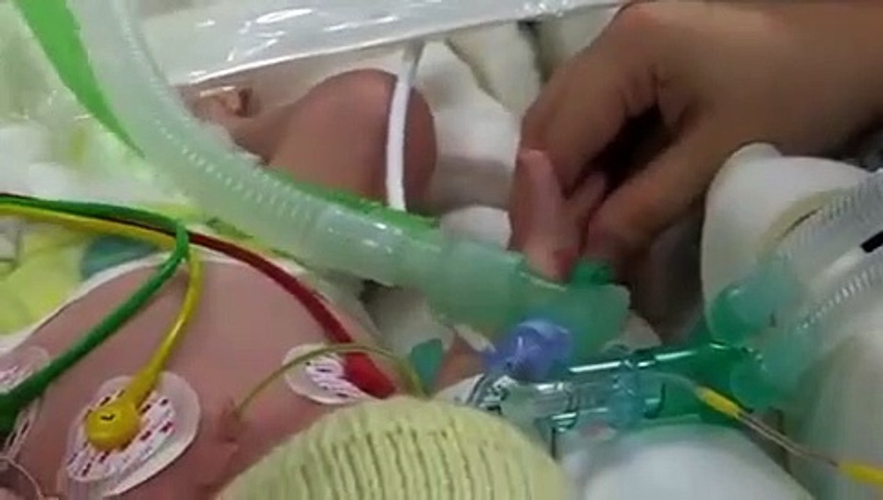 Childrens Accident And Emergency - Se2 - Ep03 HD Watch HD Deutsch