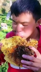 Operasi Plastik mode Hemat