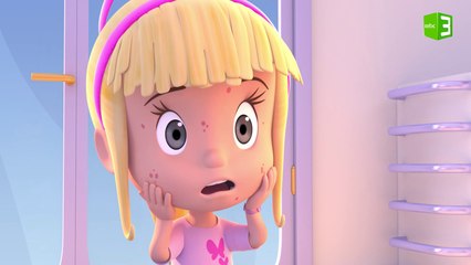 ماريبي تصاب بمرض الحكة والسبب..