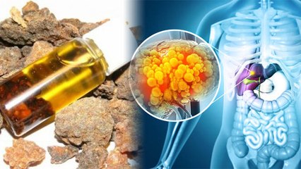 हींग तेल लगाने से क्या होता है , हींग तेल के फायदे जानकर उड़ेंगे होश | Boldsky*Health