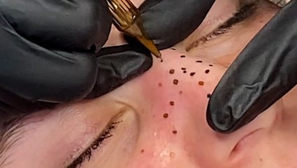 I got faux freckles tattooed