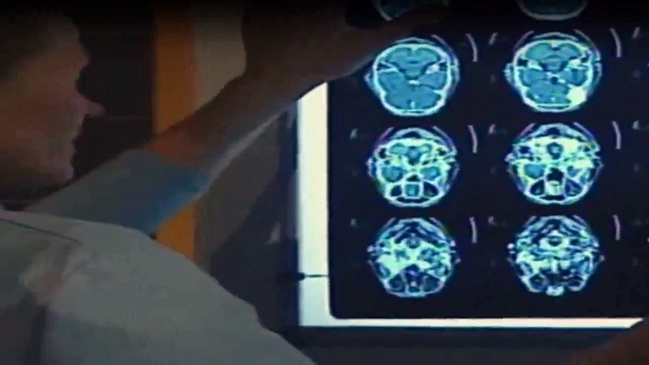 Alphateam - Die Lebensretter im OP Staffel 1 Folge 4 HD Deutsch