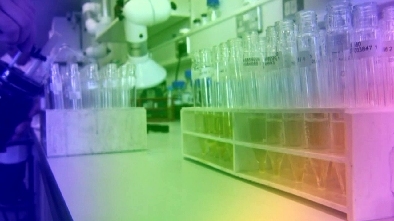 Curious Life and Death of .. Staffel 1 Folge 2 HD Deutsch