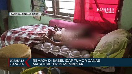 Idap Tumor Ganas, Remaja di Babel Terancam Kehilngan Penglihatan