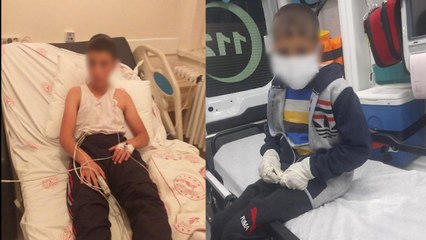 Çocuğun 3. örneğinde tükürükte  kuduz virüsü saptandı