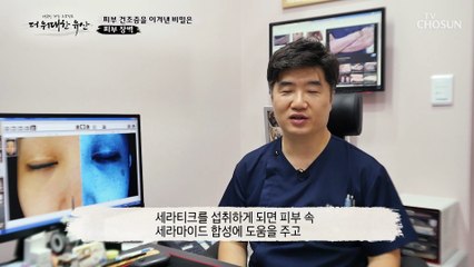 《세라티크》 건강하고 탄력 있는 피부를 위한 특급 비책 TV CHOSUN 20221103 방송