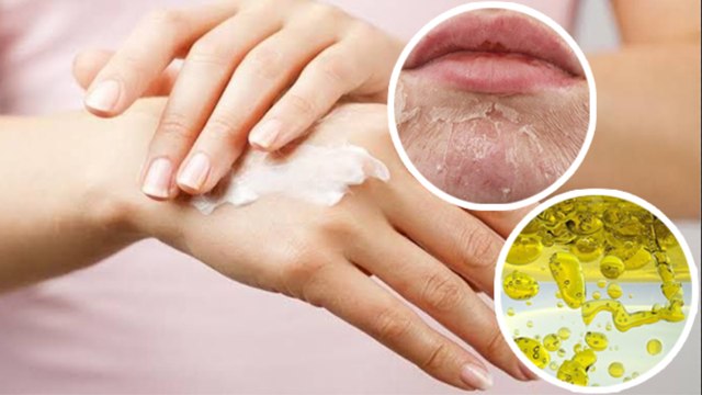 सर्दियों में त्वचा की पर्त क्यों निकलती है | Kya hai Skin Peel Ka karan | Boldsky *Health