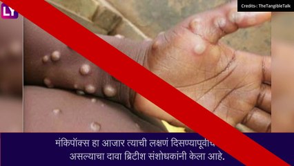 लक्षणं न दिसताही पसरतो Monkeypox हा आजार- ब्रिटिश संशोधकांचा दावा
