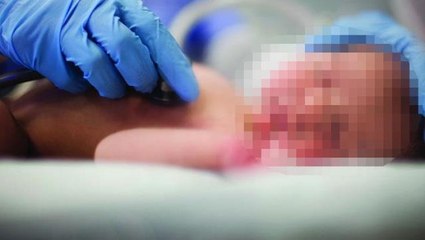 Doğumhanede bebeğin yüzünü gören aile onu terk edip gitti