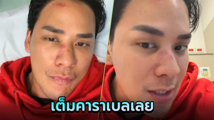 แทค ภรัณยู สภาพหลังขึ้นชก IDOL Fight เละเป็นโจ๊ก เจ้าตัวบอกเต็มกราฟฟฟ