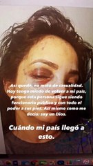 Exesposa del superintendente de Pensiones lo acusa de propinarle golpiza