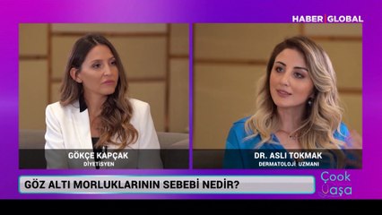 Gözaltı morluklarının sebebi nedir?