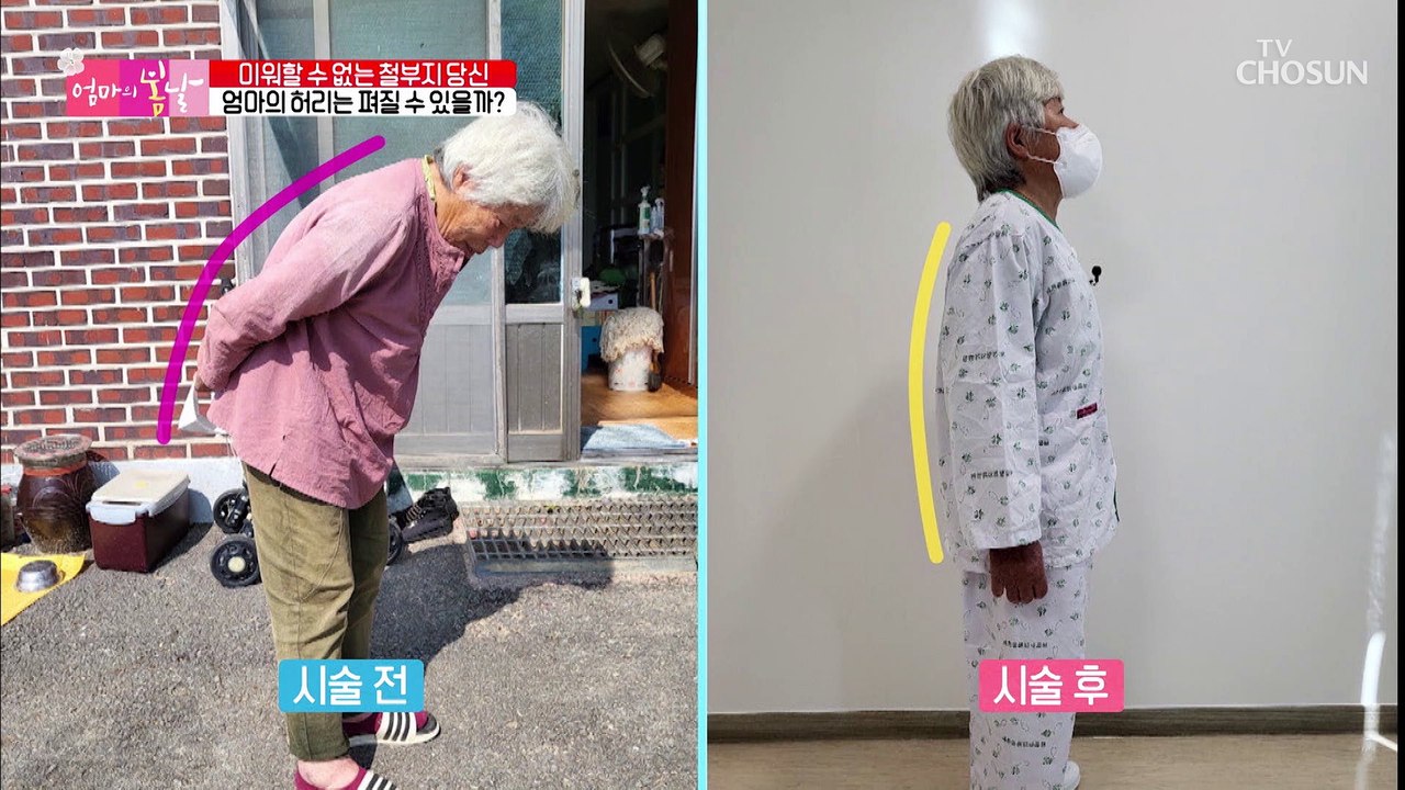 맞춤 시술과 운동 치료법으로 허리 건강을 되찾은 엄마 TV CHOSUN 2022110...